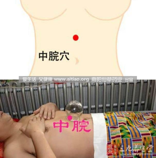 中脘穴位于腹部正中線(xiàn)，臍上4寸的位置上。每天艾灸10-15分鐘，能有效緩解胃部不適的癥狀，同時(shí)有助于祛濕。