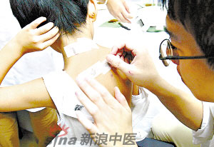 灸法的種類(lèi)  你知道多少？