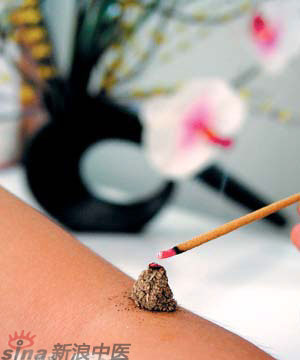 節氣灸” 冬至，你灸了嗎？